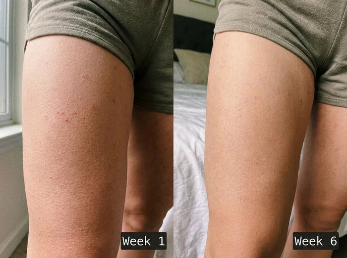 Before and after